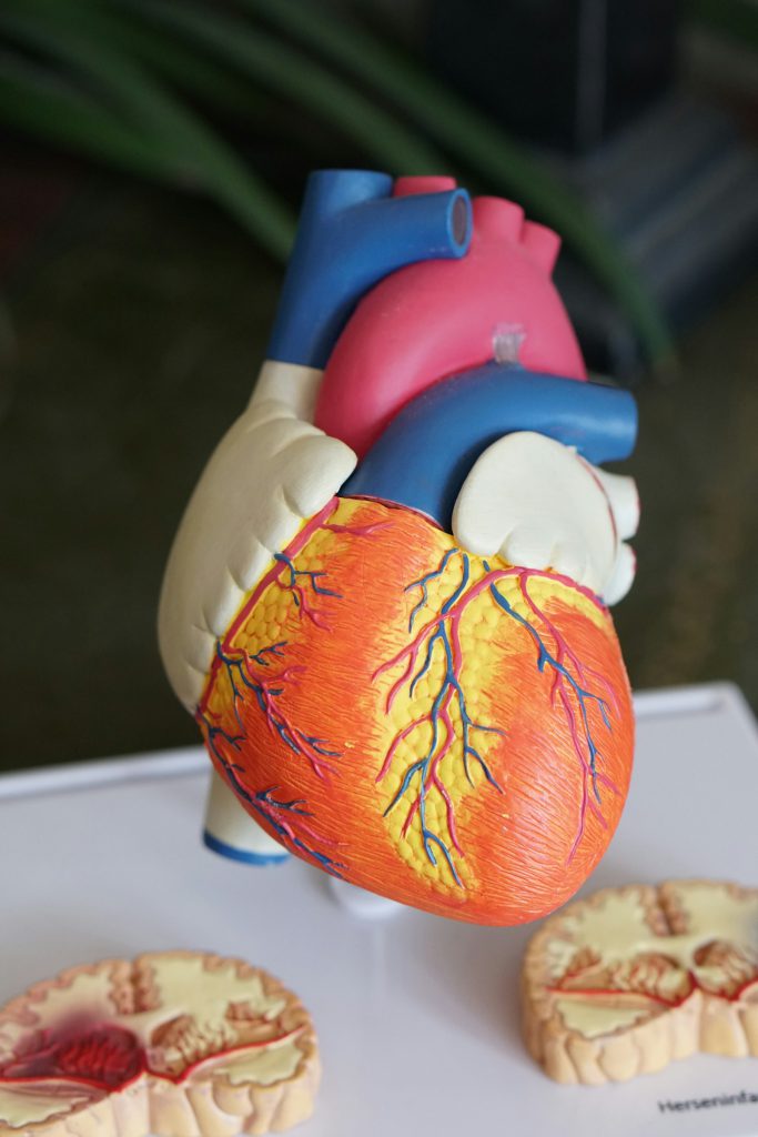 Anatomical model of a human heart