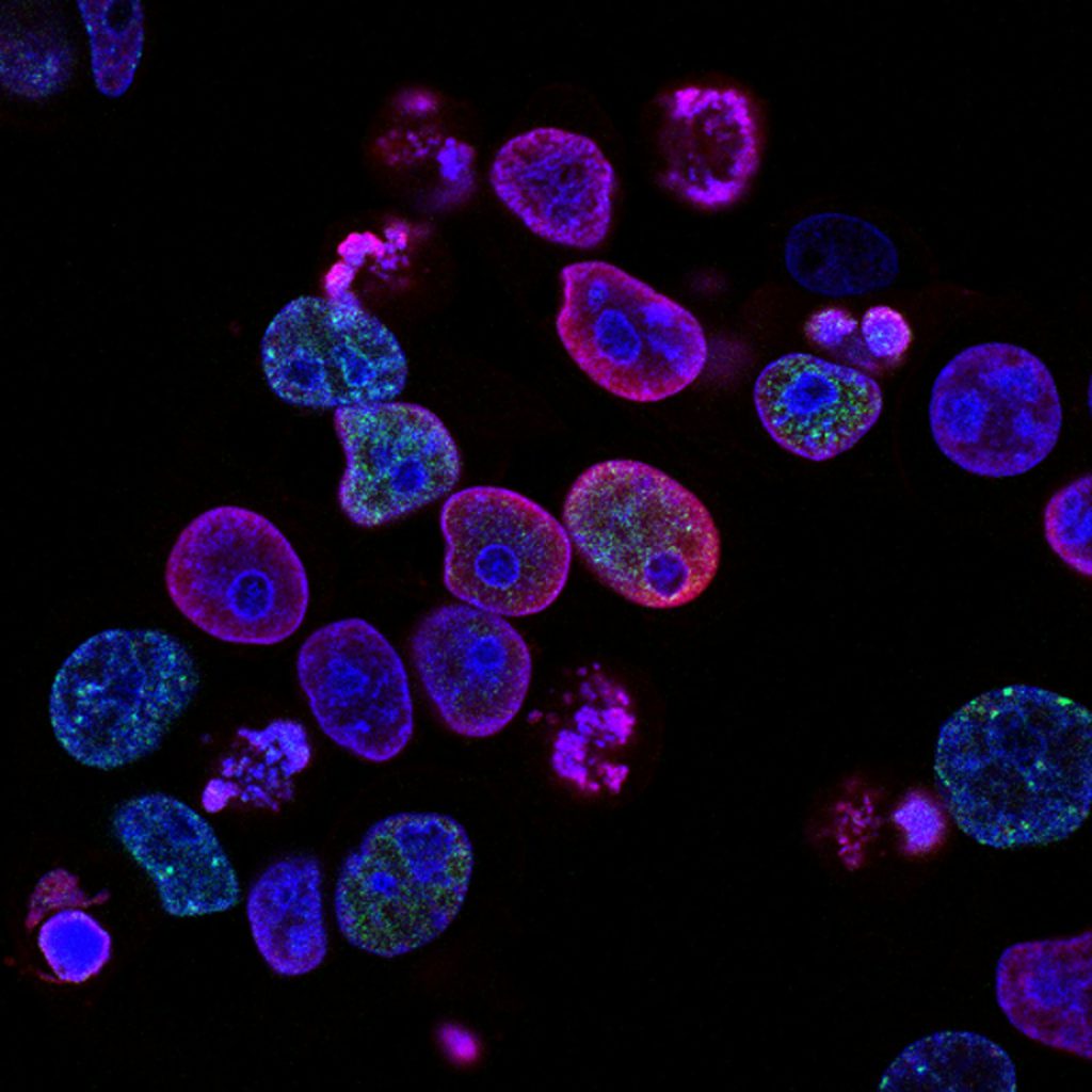 Cells under a fluorescence microscope